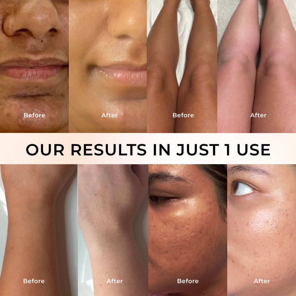 Niconi Tan Vanish Gluta Kojic Skin Polish | Instant Tan Removal