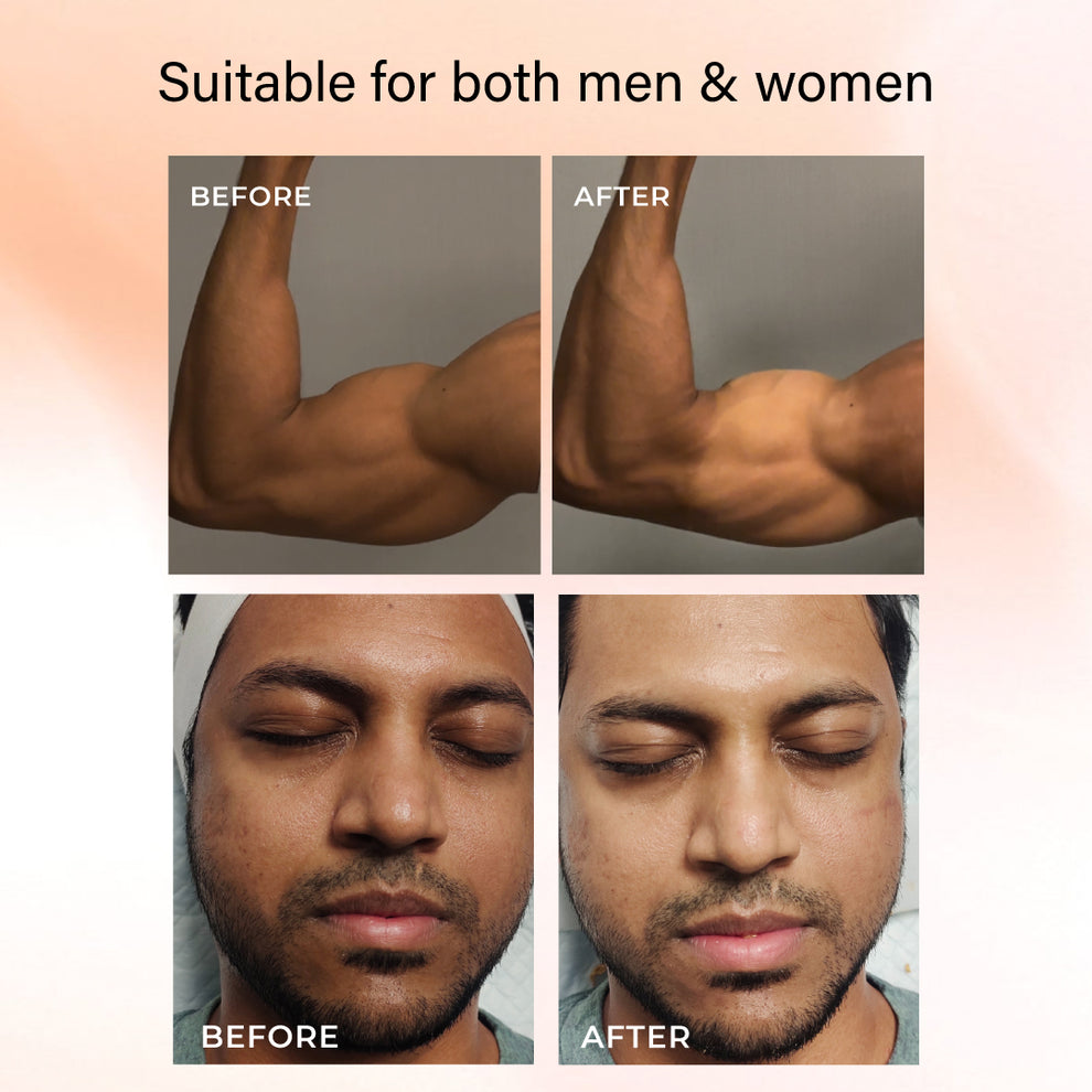 Niconi Tan Vanish Gluta Kojic Skin Polish | Instant Tan Removal